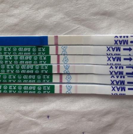 女性有染色体罗氏易位在新民市做试管养囊成功率高吗？试管移植后需要保胎吗！