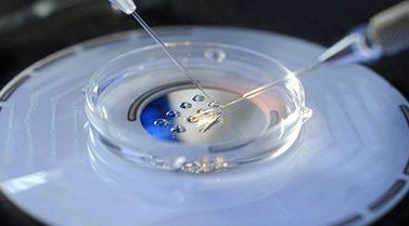 如何判断胎儿试管取决于四维彩超的孩子小窍门？