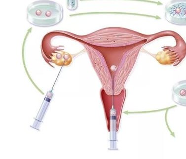 南京可以特需的私营医院有吗？附国内特需试管医院推荐